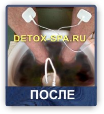  Ion Detox Spa    